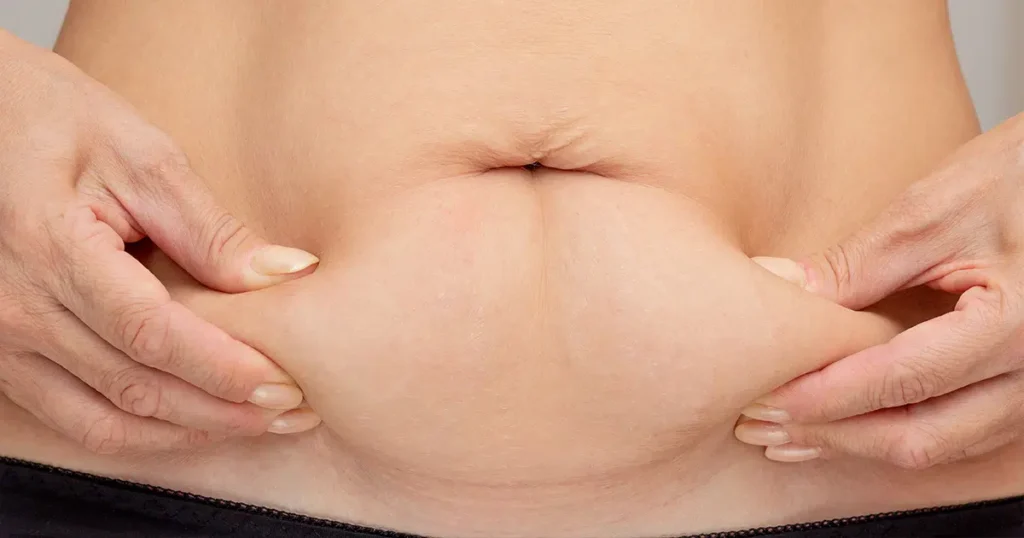 Woman with lower belly pooch