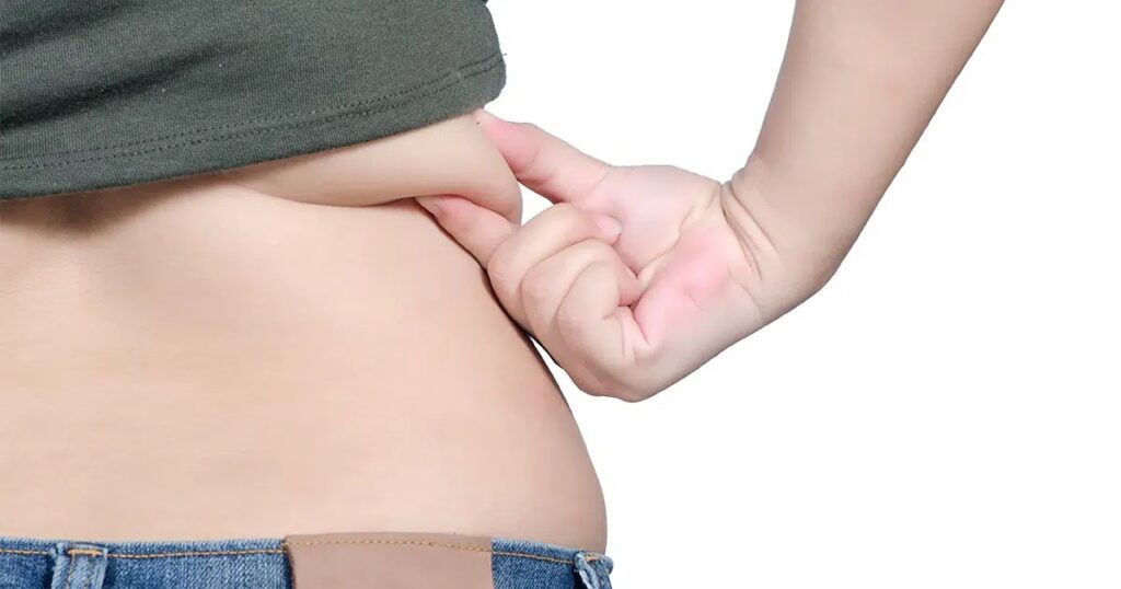 Close-up of a person pinching mild swelling or loose skin around the lower back area, representing post-operative swelling after a circumferential body lift.