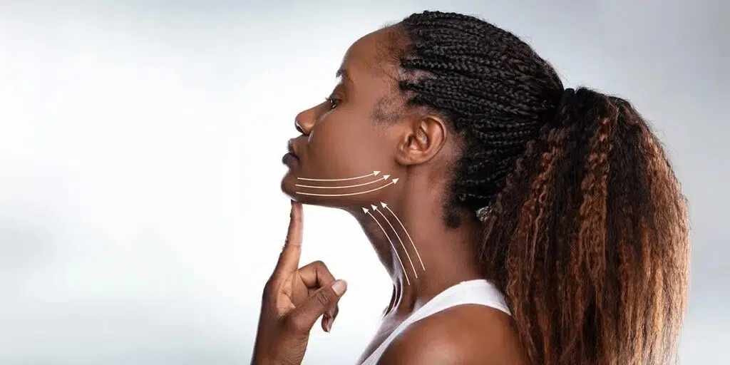 Woman touching her chin in profile, upward arrows along her neck and jawline showing lift direction