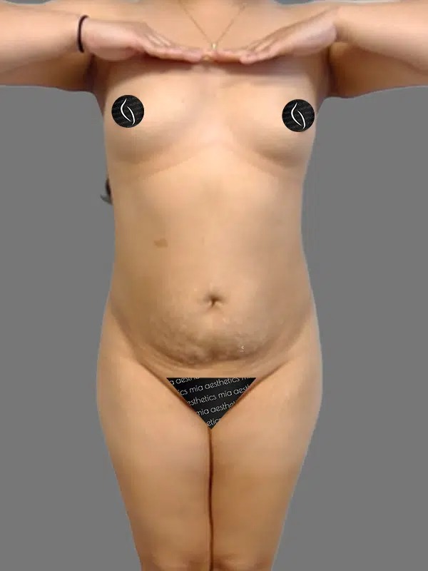 Before Treatment – Case 5001