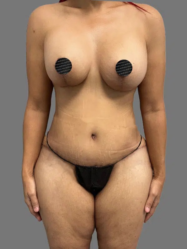 After Treatment – Case 5002