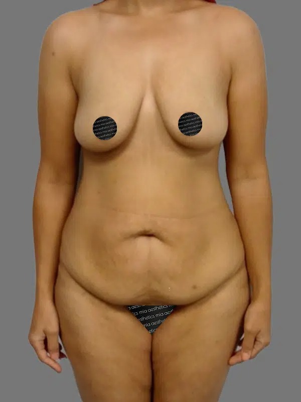 Before Treatment – Case 5002