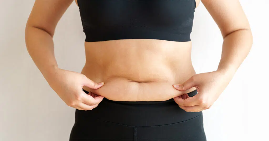 A slightly overweight woman grabbing her stress belly