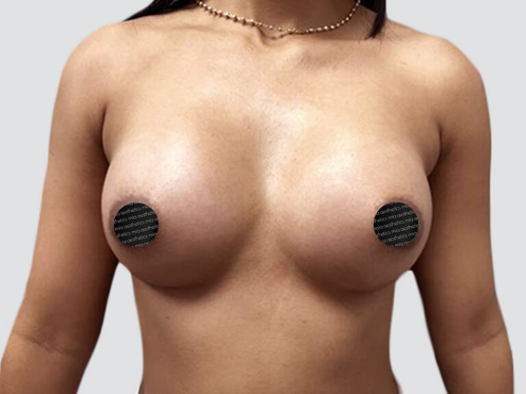 After Treatment – Case 2012