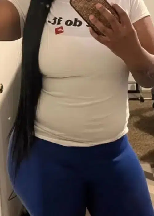 Before procedure