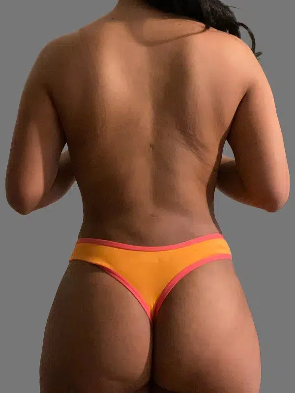 Lipo 360 after photo – Mia Aesthetics