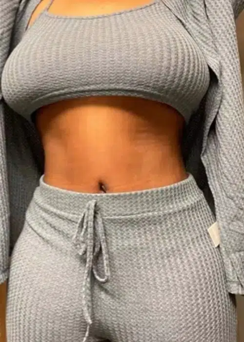 After procedure