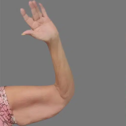 Before Treatment – Case 6001