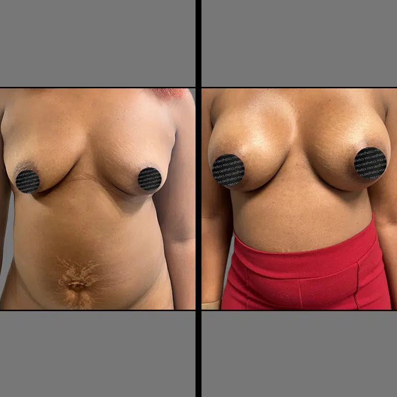 Dr. Cooper • Breast Procedures • image 2