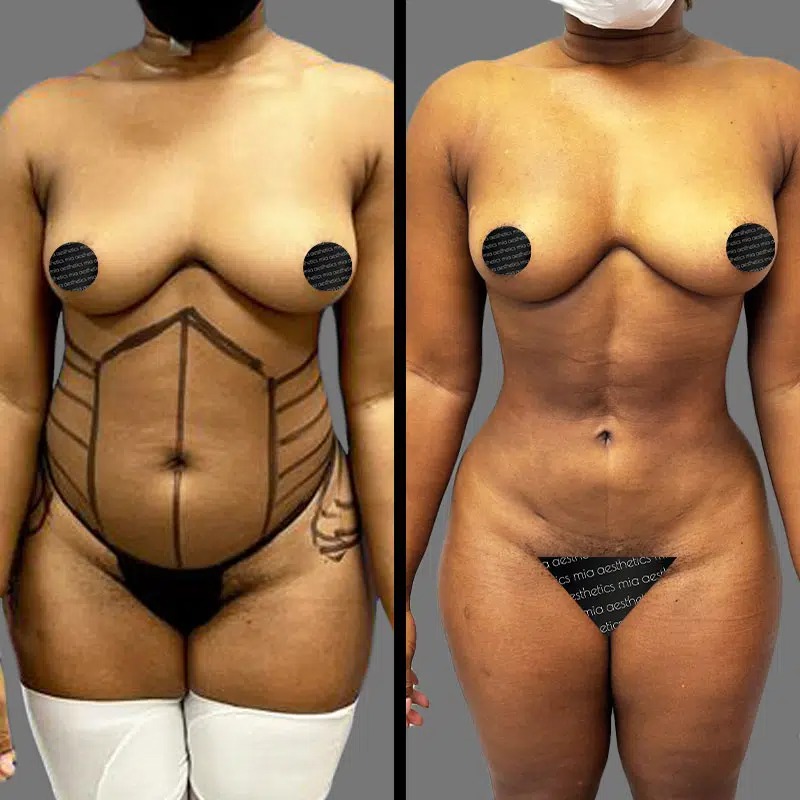 Dr. Fasusi • Lipo 360 • image 1