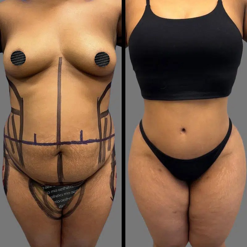 Dr. Fasusi • Lipo 360 • image 2