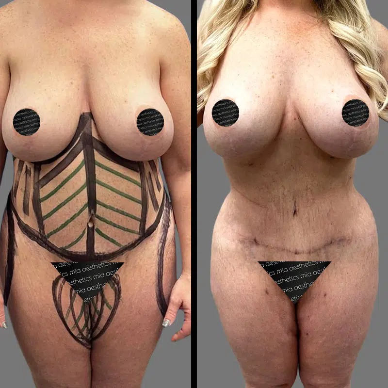 Dr. Fasusi • Lipo 360 • image 3
