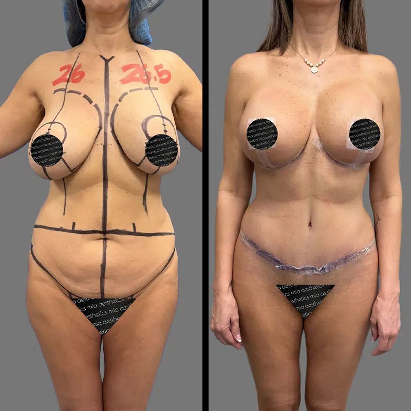 Dr. Fasusi • Mommy Makeover • image 1