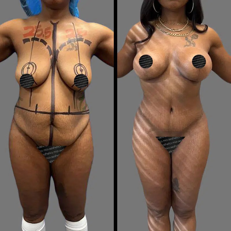 Dr. Fasusi • Mommy Makeover • image 2