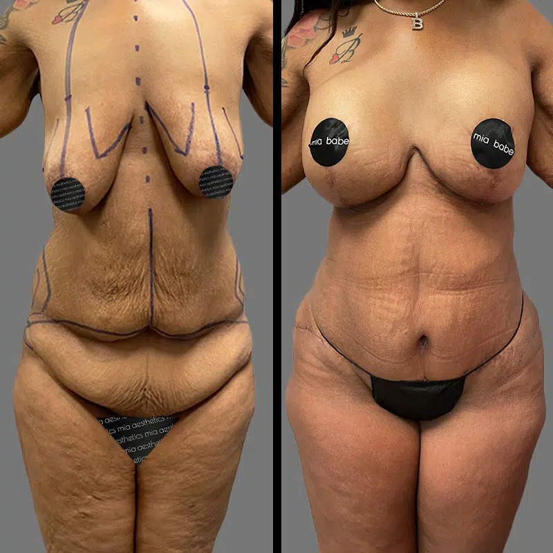 Dr. Gray • Mommy Makeover • image 2