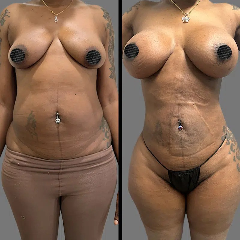 Dr. Horowitz • Lipo 360 • image 1