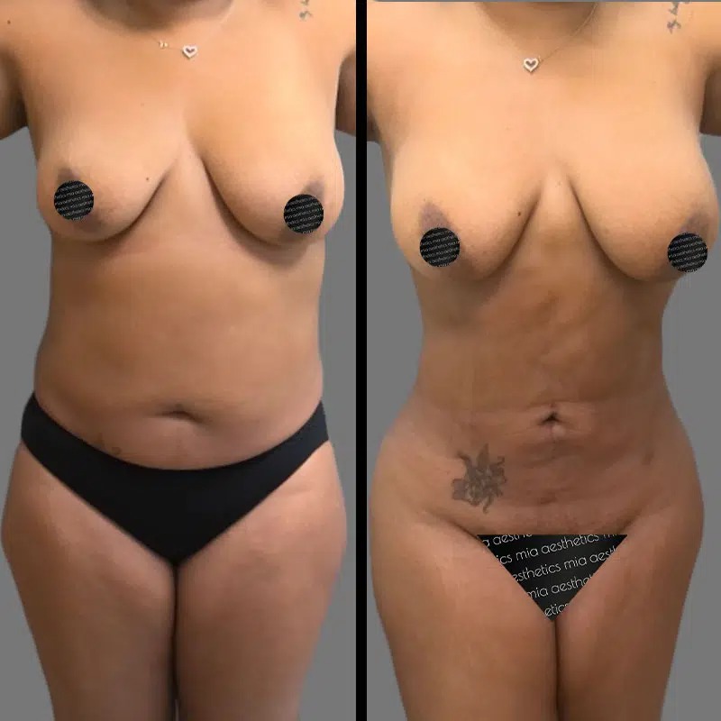 Dr. Kumar • Lipo 360 • image 2