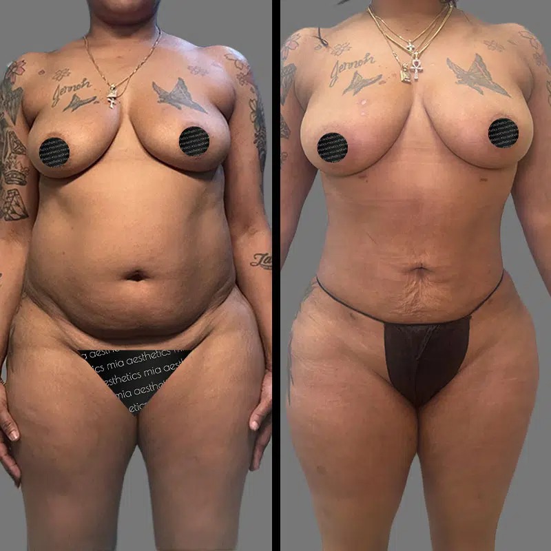 Dr. Kumar • Lipo 360 • image 3