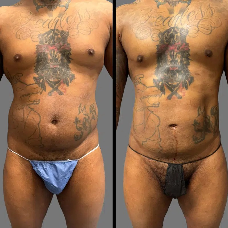 Dr. Mehio • Lipo 360 • image 5