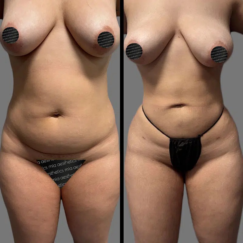 Dr. Orlando • Lipo 360 • image 1