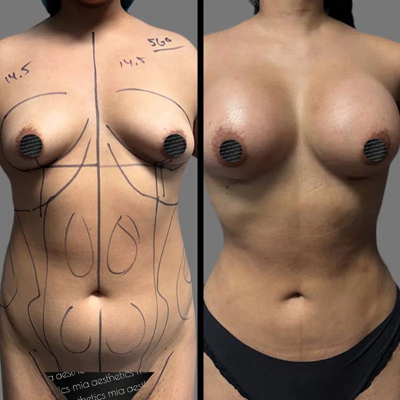 Dr. Orlando • Lipo 360 • image 2