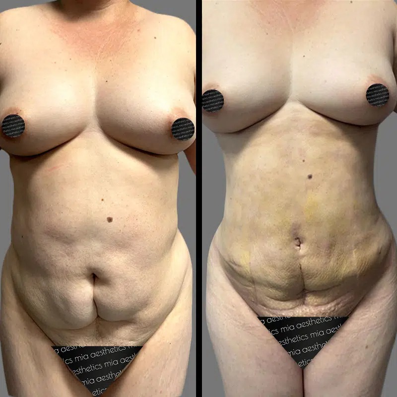 Dr. Orlando • Lipo 360 • image 3