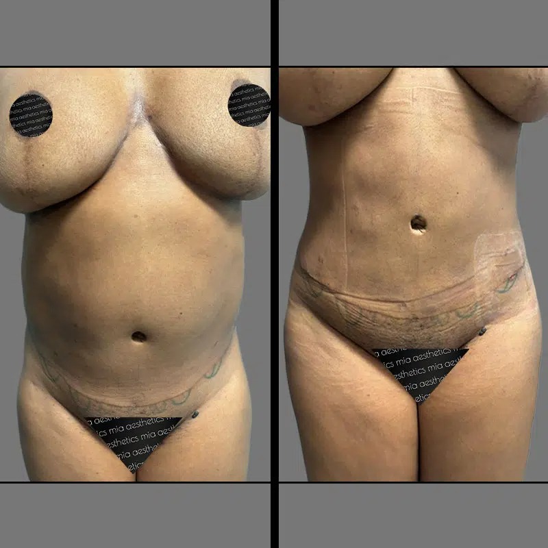 Dr. Orlando • Lipo 360 • image 5