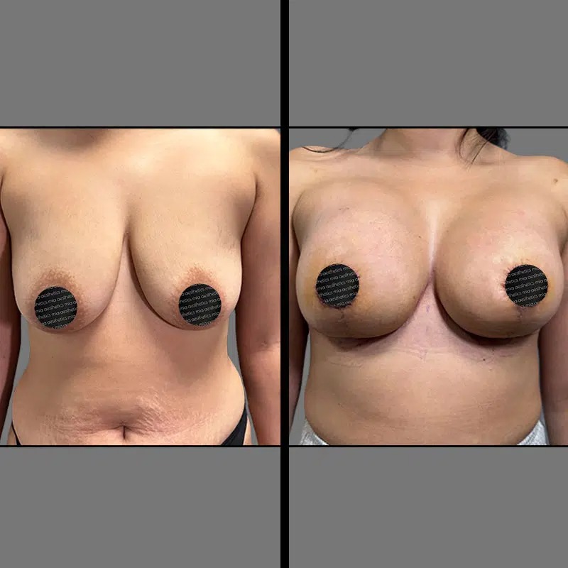 Dr. Wright • Breast Procedures • image 4