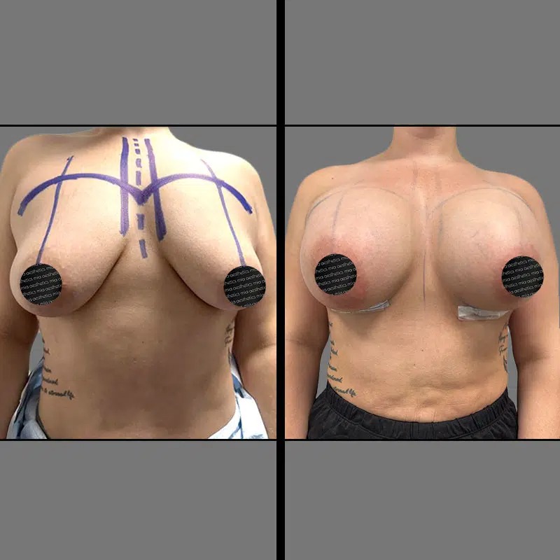 Dr. Wright • Breast Procedures • image 1