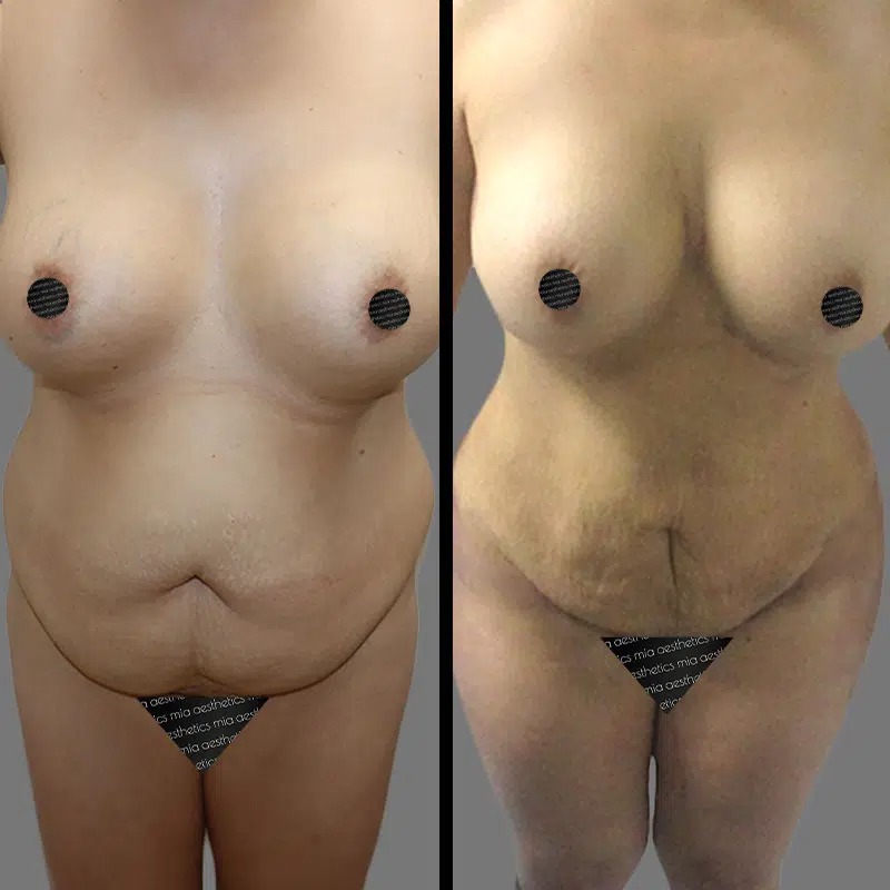 Dr. Wright • Lipo 360 • image 1