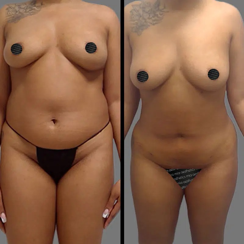 Dr. Wright • Lipo 360 • image 2