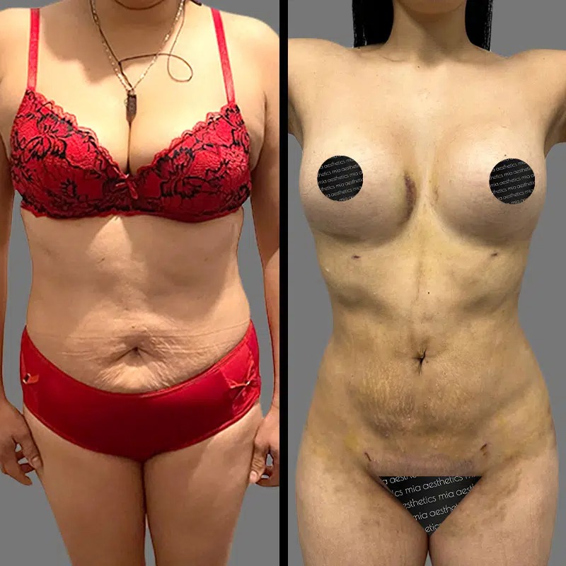 Dr. Xu • Lipo 360 • image 1