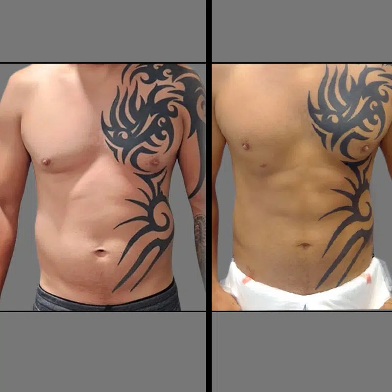 Dr. Ziakas • Lipo 360 • image 2