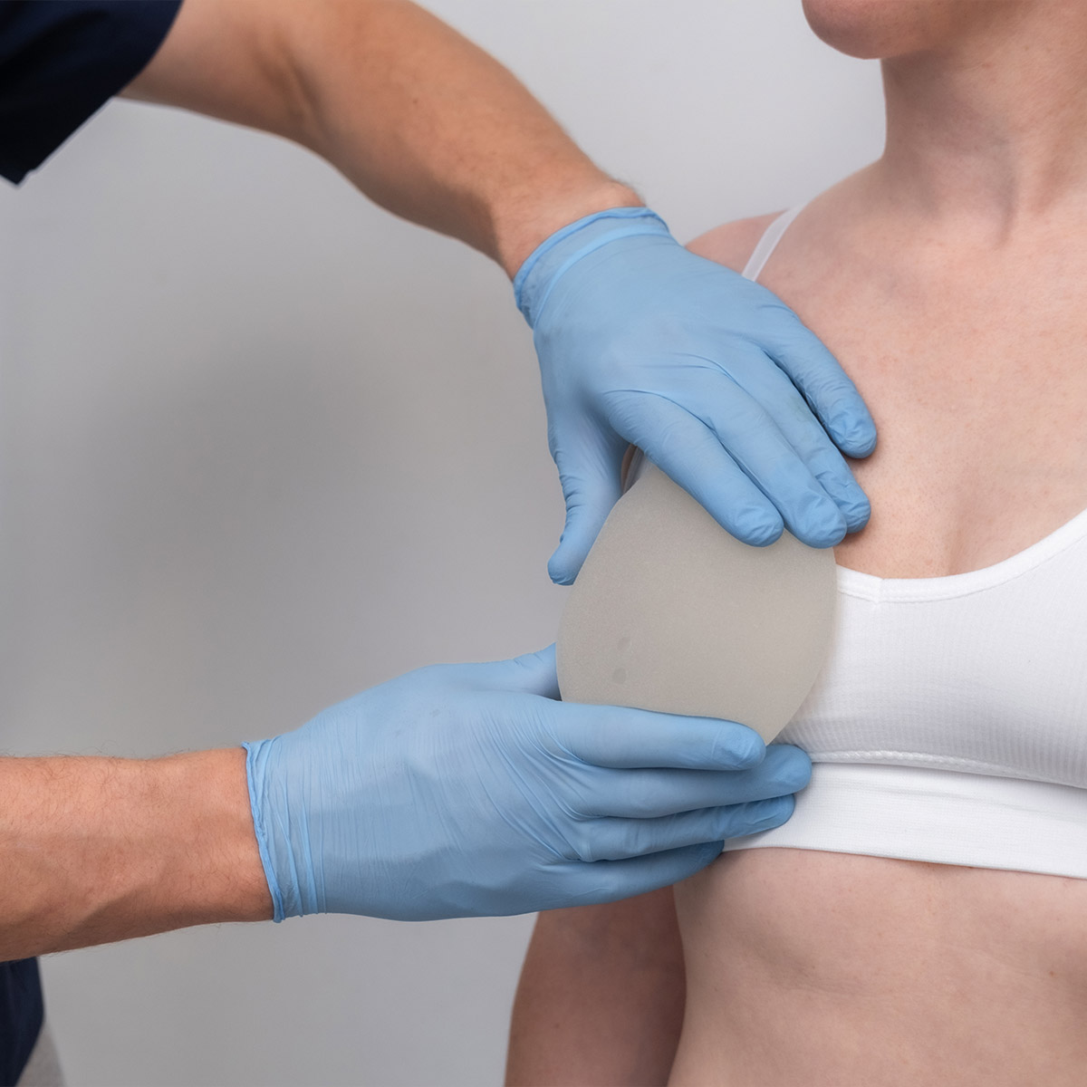 Implant Revision Candidate