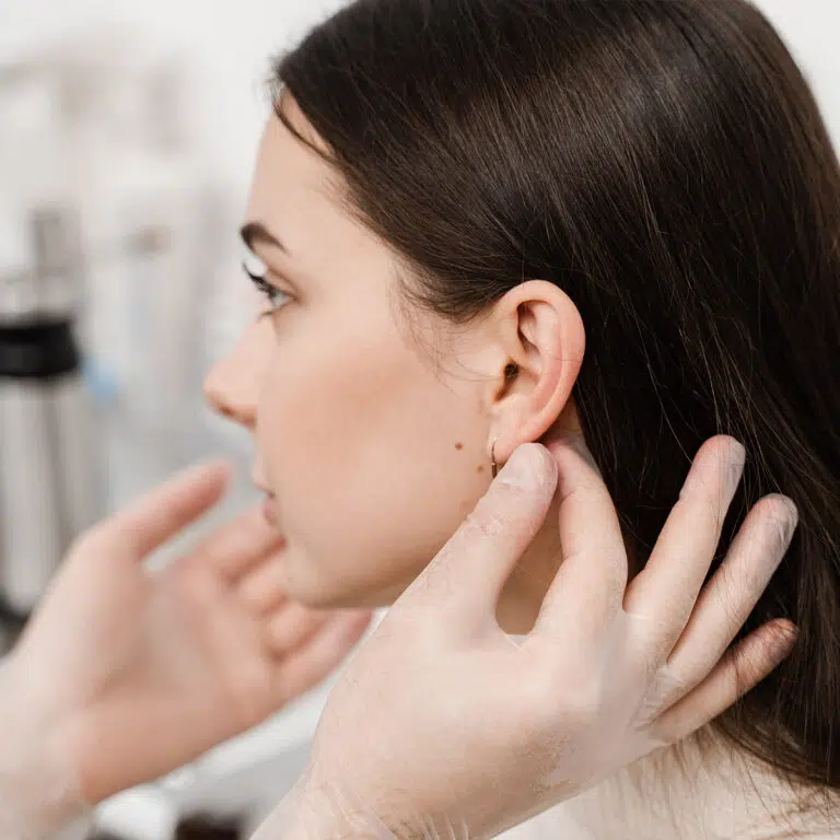 Otoplasty Process
