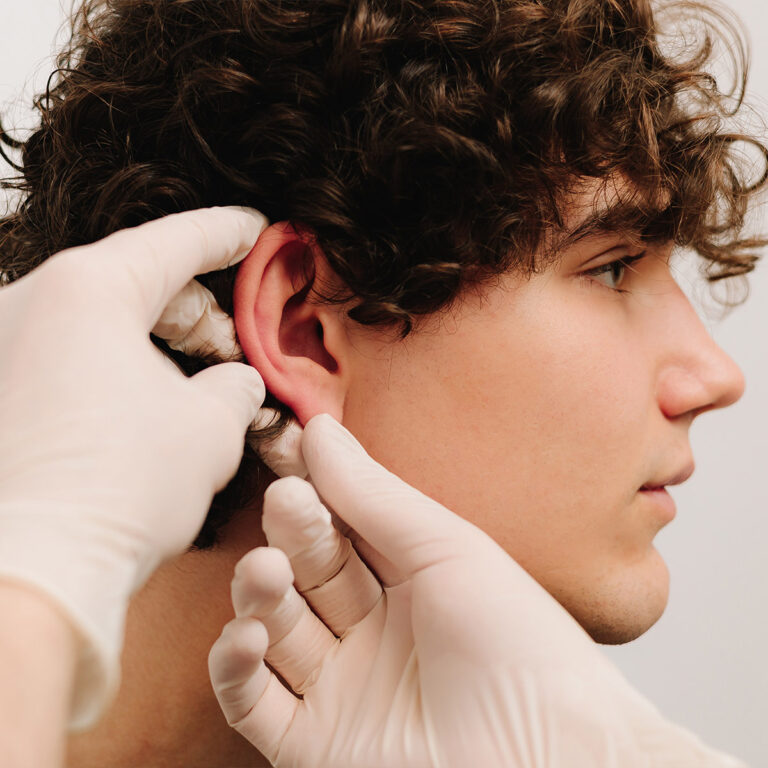 Otoplasty Recovery