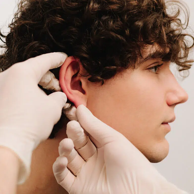 Otoplasty Recovery